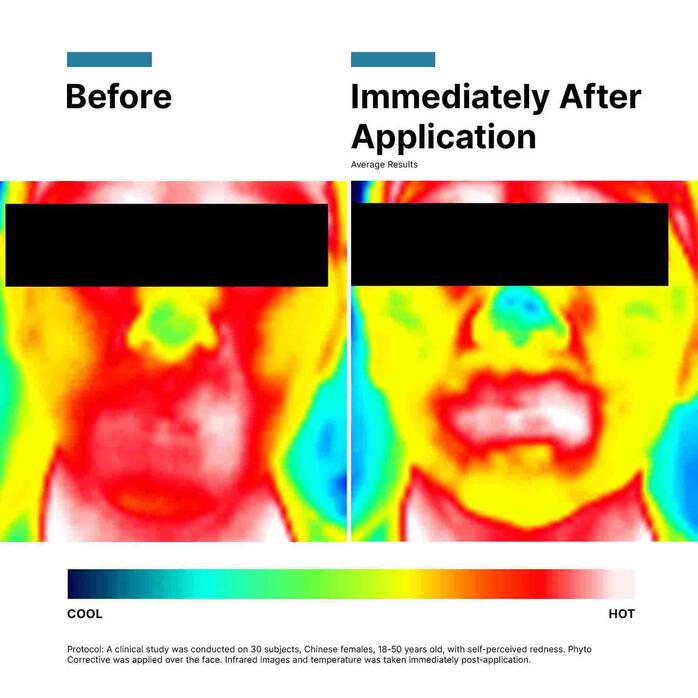 Phyto Corrective Gel - Image 7